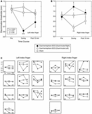 The Effect of Dual-Hemisphere Transcranial Direct Current Stimulation Over the Parietal Operculum on Tactile Orientation Discrimination